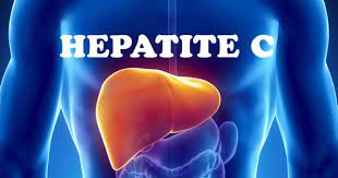 hepatita c