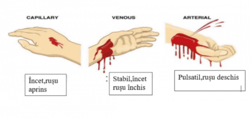 clasificarea hemoragiilor
