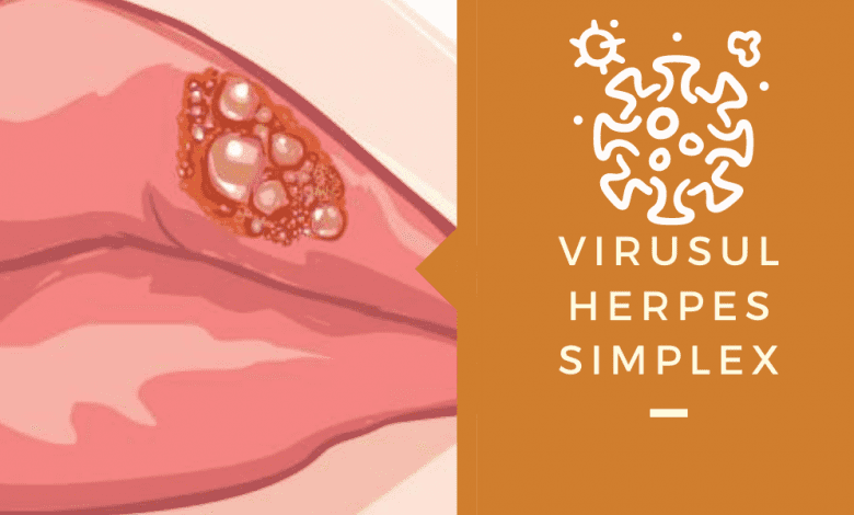 herpes simplex