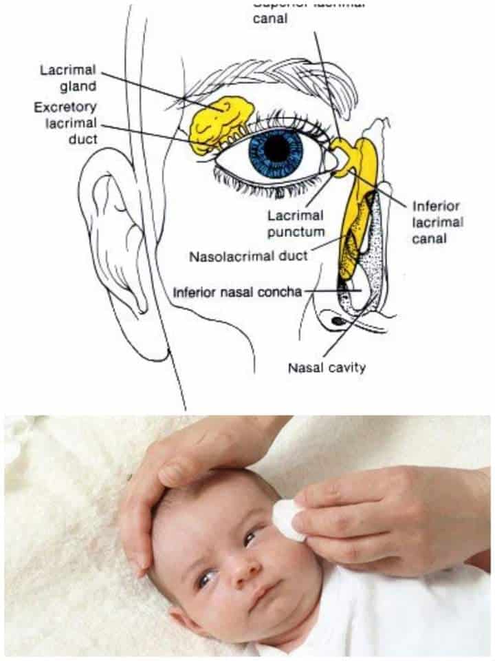 canalul lacrimal la copii