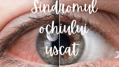 sindromul_ochiului_uscat-1