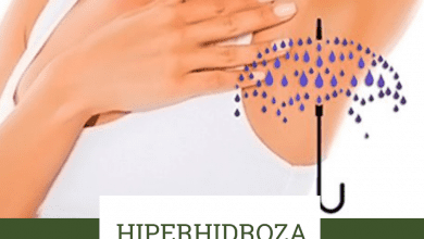 hiperhidroza