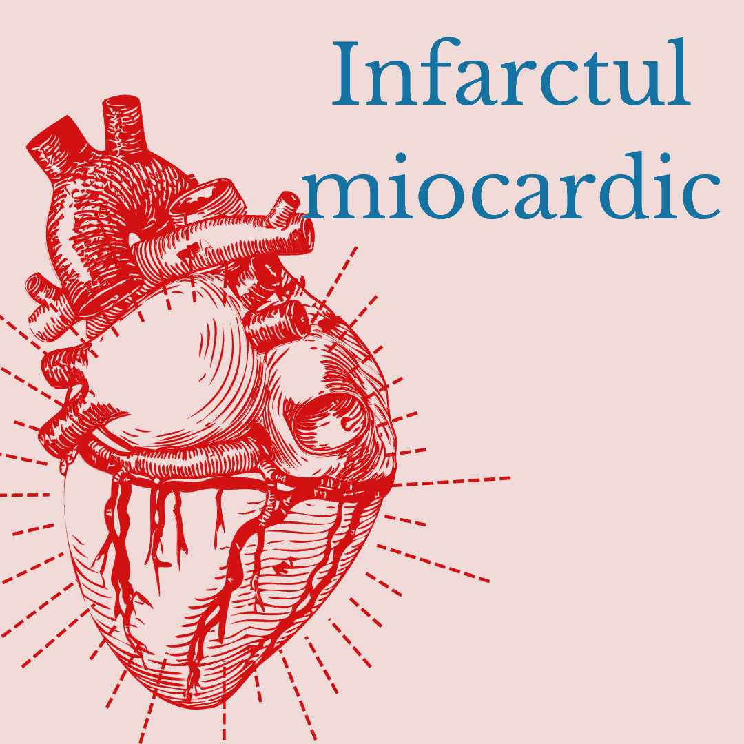 infarctul miocardic