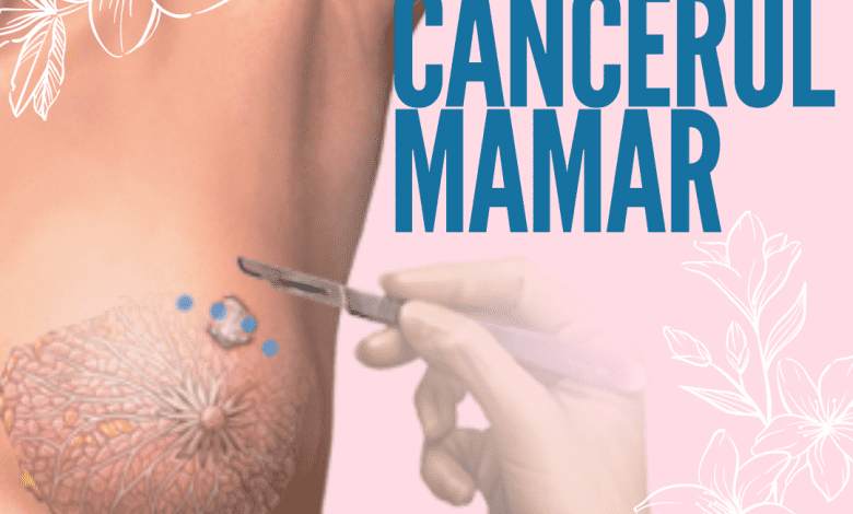 cancer mamar