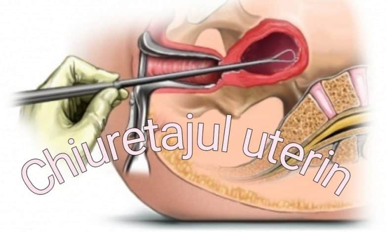 chiuretajul uterin