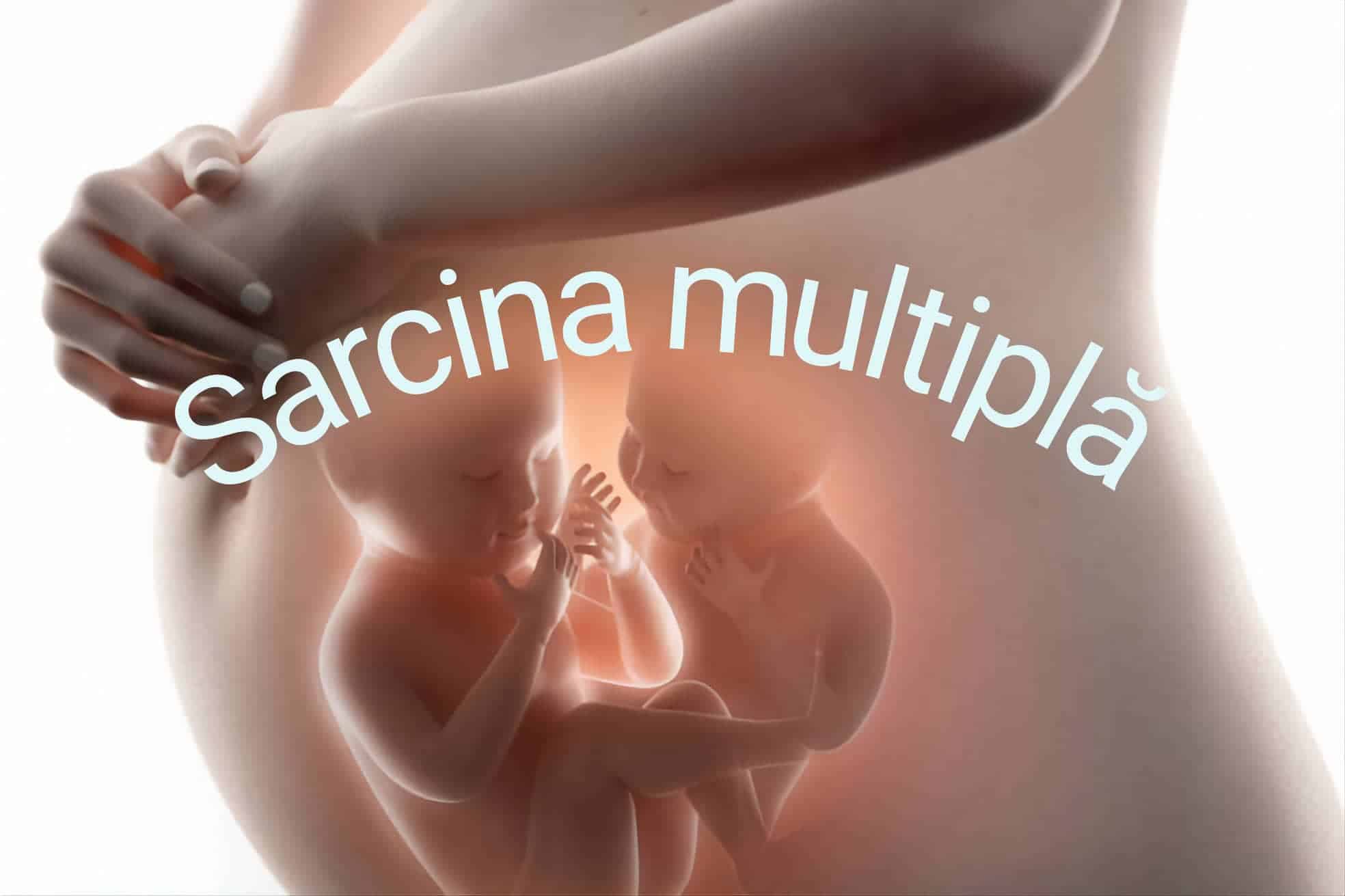 sarcina