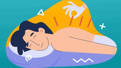 acupunctura